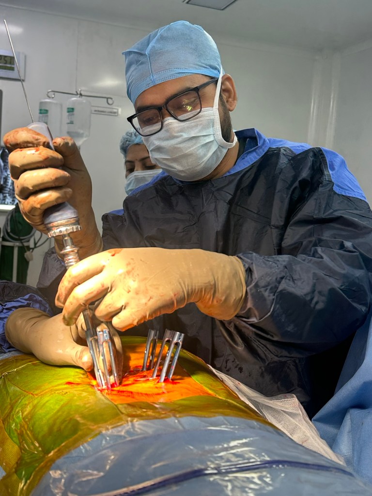 Dr Om Patil Performing minimal invasive endoscopic spinal fusion surgery with percutaneous screw and rod fixation. Dr Om Patil is renowned orthopedic spine surgeon in Mumbai 